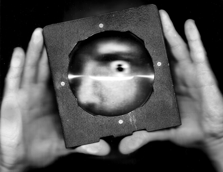 Retinal Exam expanded